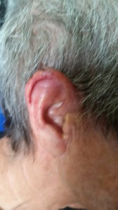 Sorry not showing blood just the damage.